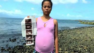 真的懷了魚寶寶嗎？菲律賓少女疑跟海中異形「亂來」致肚子變大，超音波發現「魚寶寶」！