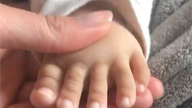 寶寶「腳趾」比手指還長？媽媽看了非常苦惱　網友紛紛擔憂：快去醫院