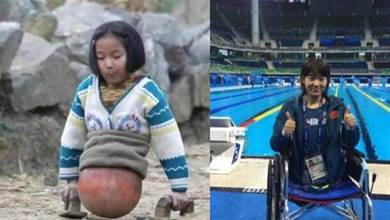 還記得「籃球女孩」嗎？4歲出意外「籃球當雙腳」 21年後「走向全世界」成為國民女神